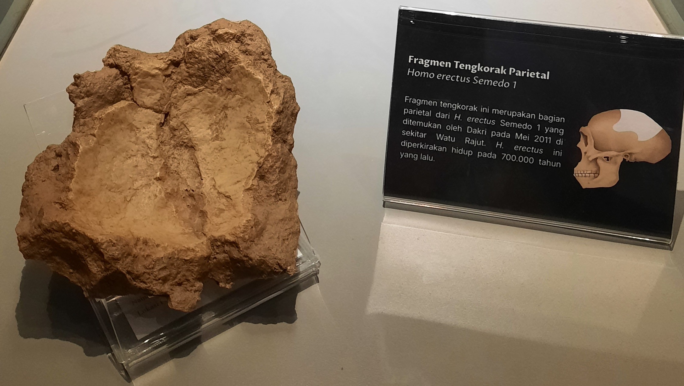 Tengkorak Parietal